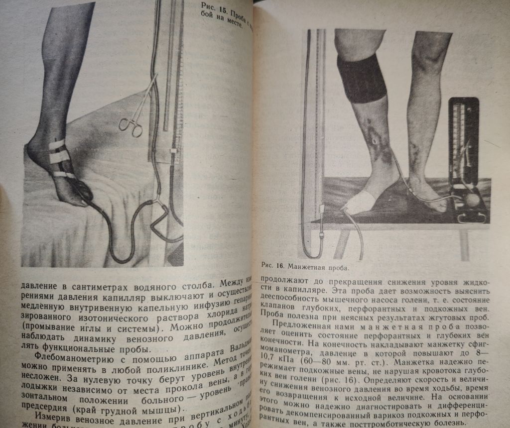 книга: БОЛЕЗНИ ВЕН И ЛИМФАТИЧЕСКОЙ СИСТЕМЫ КОНЕЧНОСТЕЙ 1984г. - фото фото фото 7
