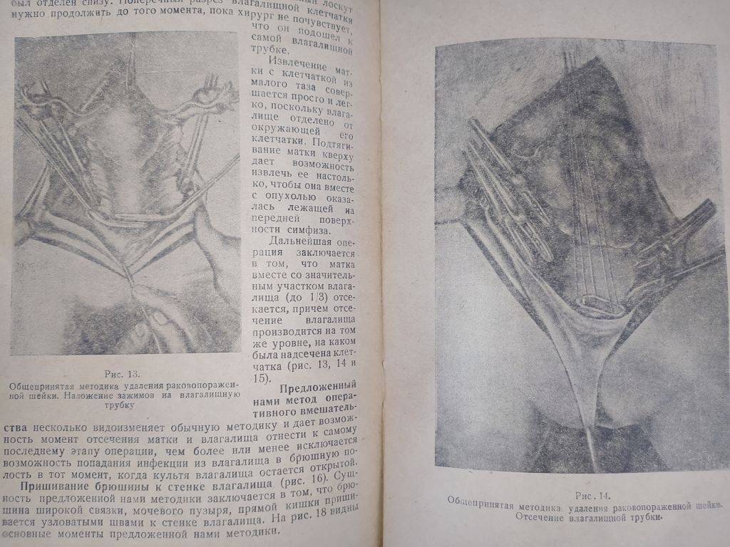 книга: ПРОФИЛАКТИКА, КЛИНИКА И ТЕРАПИЯ РАКА МАТКИ 1947г. - фото фото фото 10