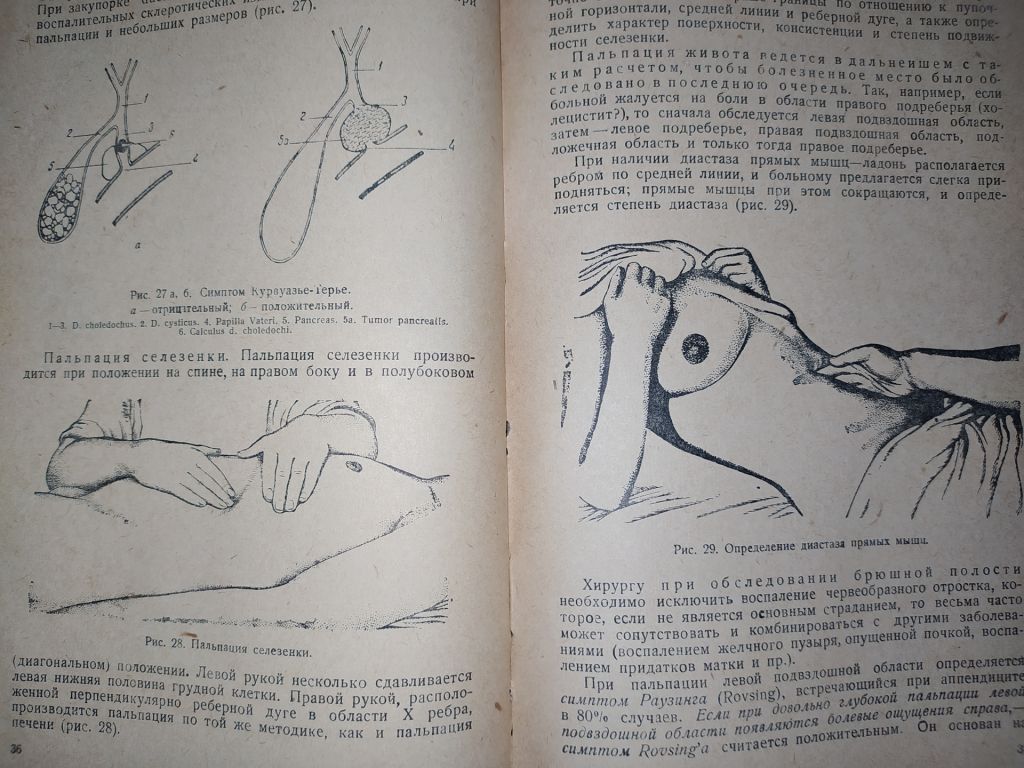книга: МЕТОДИКА ИССЛЕДОВАНИЯ ХИРУРГИЧЕСКОГО БОЛЬНОГО, II-е изд., 1938г. - фото фото фото 4