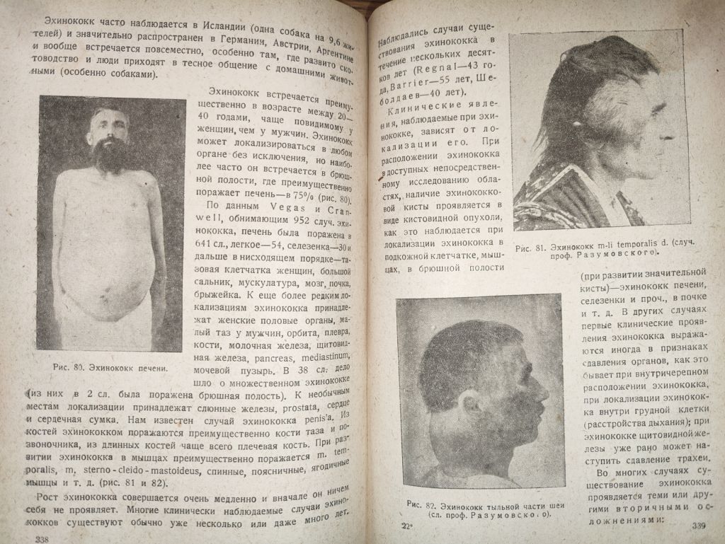 книга: ОСНОВЫ ОБЩЕЙ ХИРУРГИИ, том II, 1937г.; - фото фото фото 9