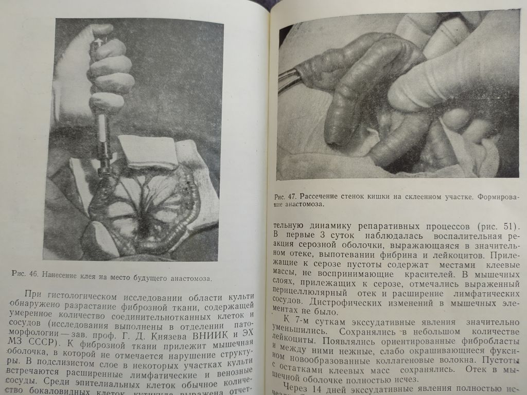 книга: БЕЗЫГОЛЬНЫЕ ИНЪЕКЦИИ 1980г. - фото фото фото 7