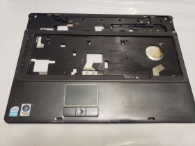 Корпуса Корпуса ^/--/^ корпус нoyтбука Acer Extensa/TravelMate 7620 7320 7520 - топкейс/палмрест    (60.4 /--/ U /--/ 009.006) ^_^^^ корпус нoyтбука Acer Extensa/TravelMate 7620 7320 7520 - топкейс/палмрест (60.4 /--/ U /--/ 009.006) - фото фото фото