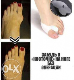 Інше Другое ^/--/^ Valgus pro Вальгус коректор фіксатор пальця ноги від шишок і б... ^_^^^ Valgus pro Вальгус корректор фиксатор пальца ноги от шишек и б... - фото фото фото