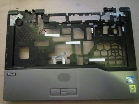 Корпуса Корпуса ^/--/^ корпус ноутбука Fujitsu LifeBook S /--/ 752 - средняя часть/палмрест/топкейс ^_^^^ корпус ноутбука Fujitsu LifeBook S /--/ 752 - середня частина/палмрест/топкейс - фото фото фото